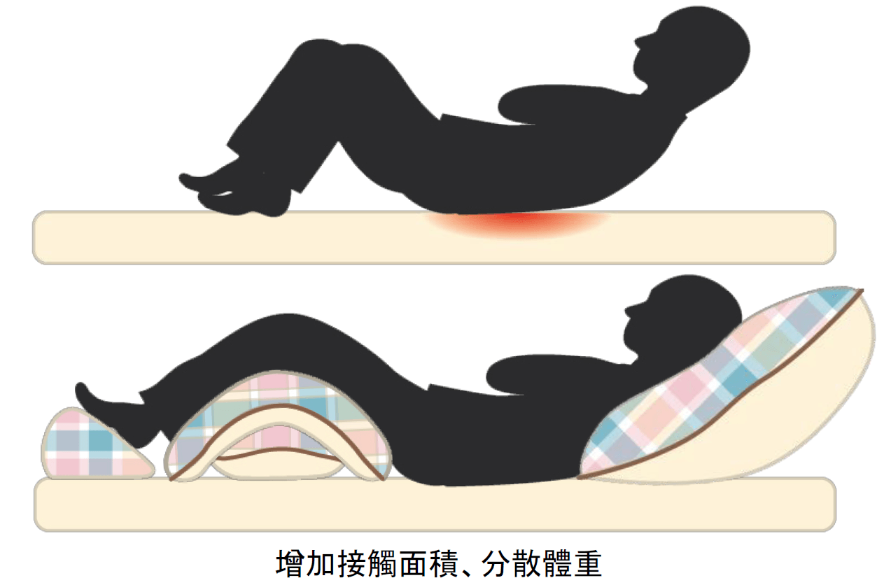 褥瘡預防