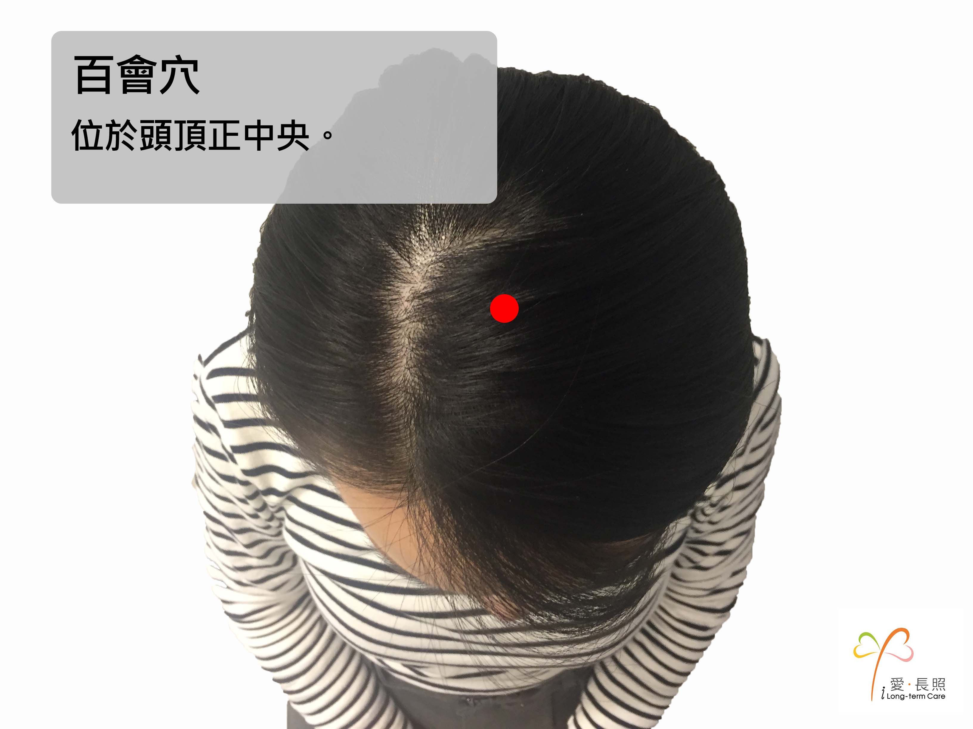 百會穴