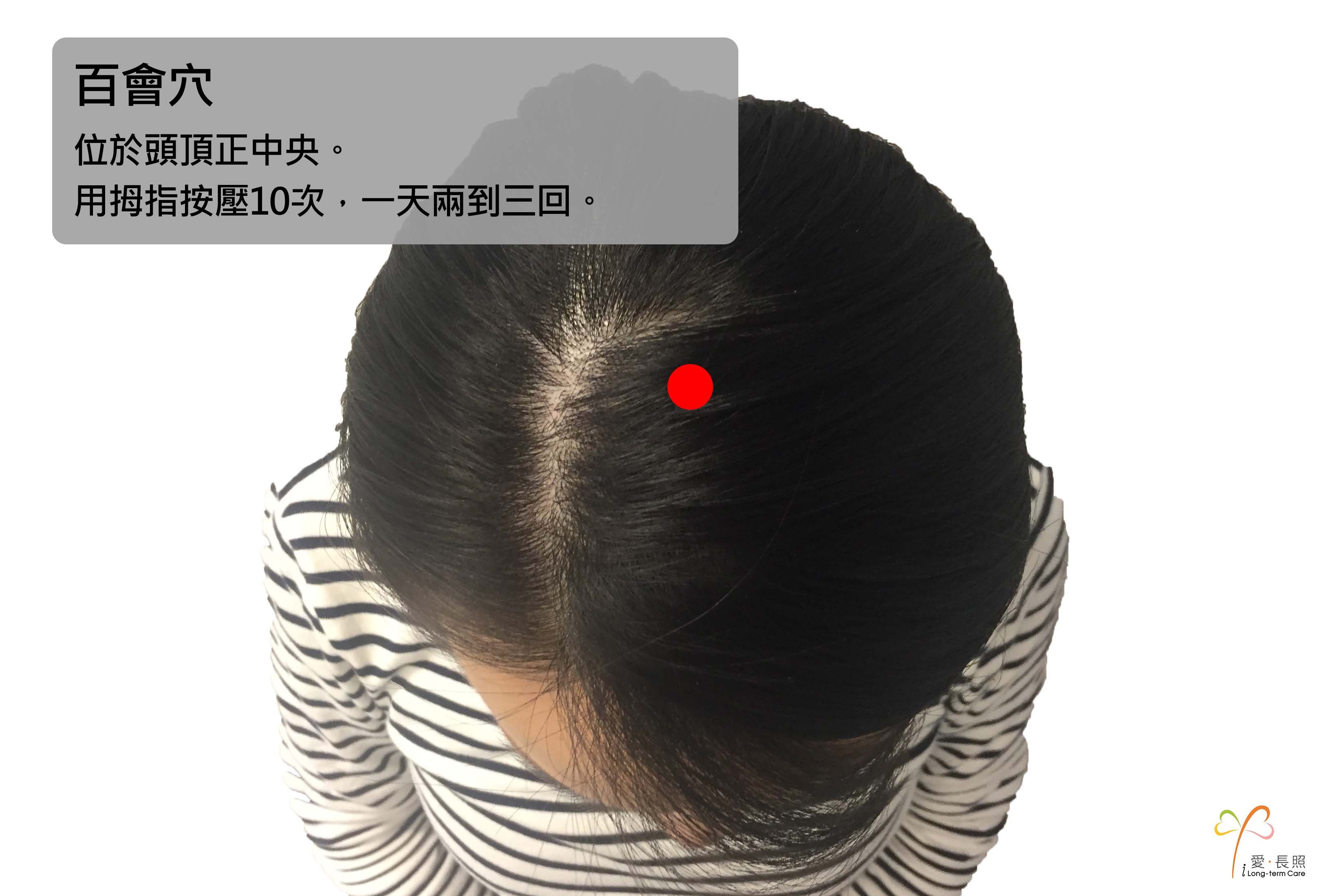 失智
