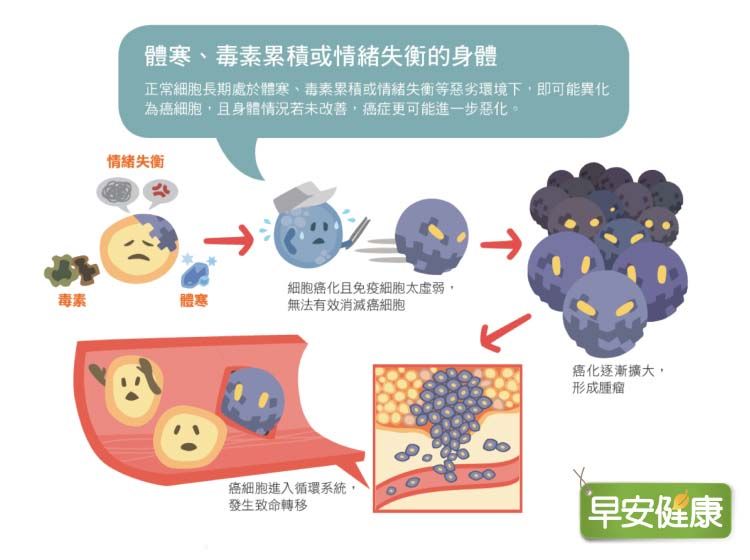 癌症