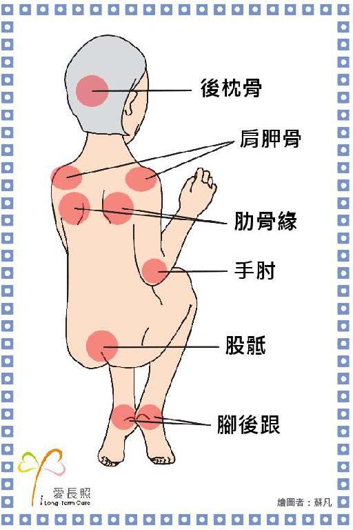 壓傷部位 