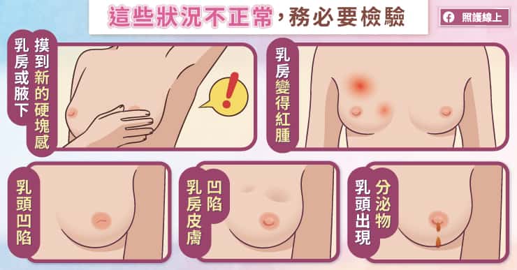 乳房