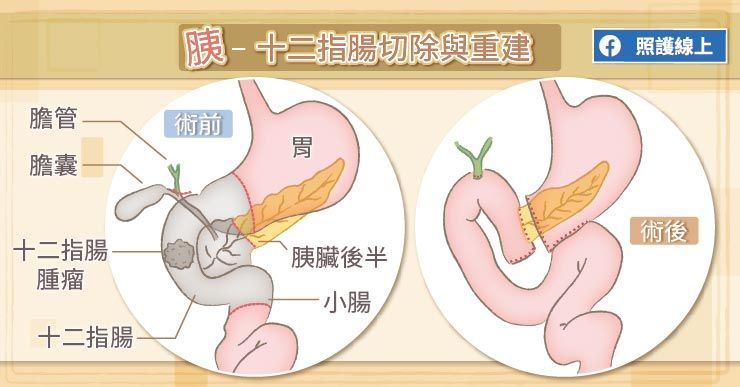 十二指腸