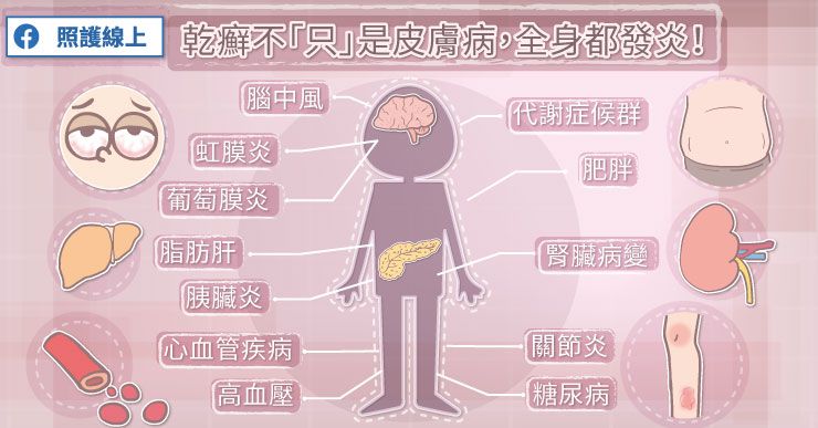 乾癬