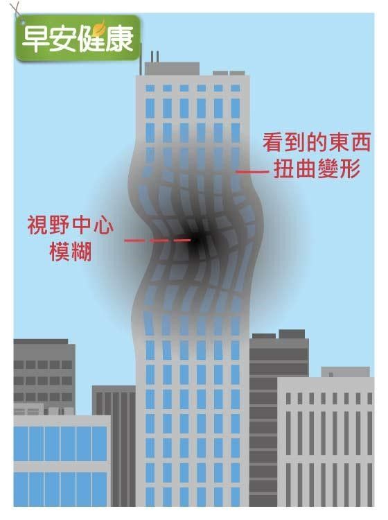 黃斑部病變