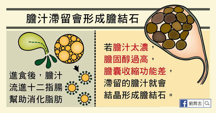 膽汁