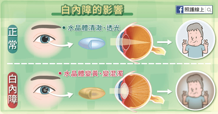 水晶體