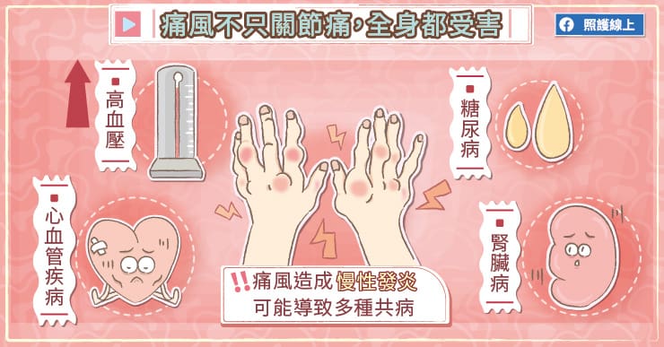 關節