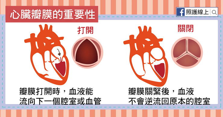 瓣膜