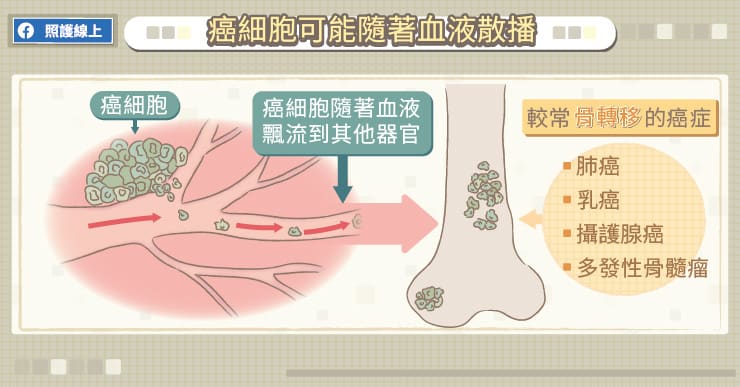 癌細胞