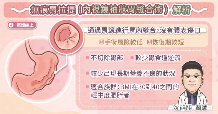 無痕胃拉提(內視鏡袖狀胃縫合術）