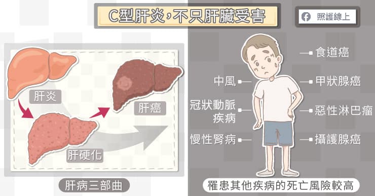 肝炎