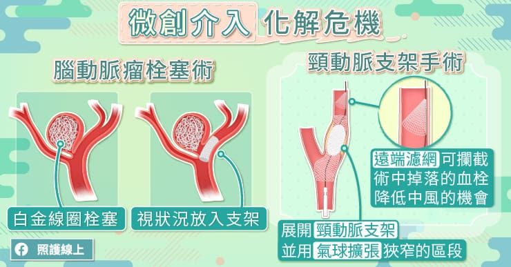 支架