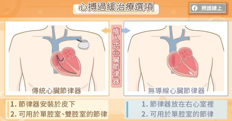 心臟
