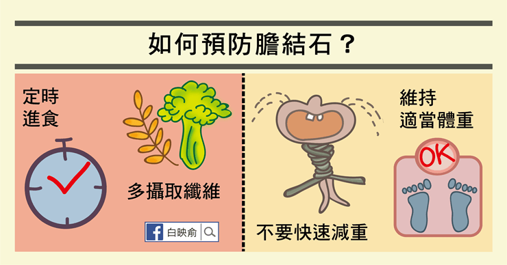 膽結石