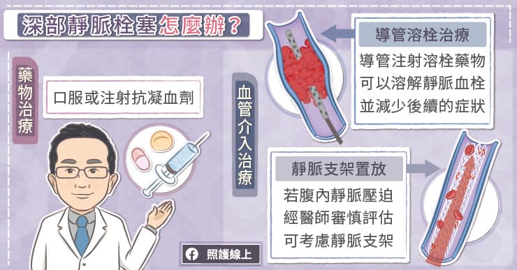 靜脈