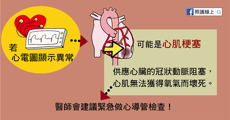 心肌梗塞