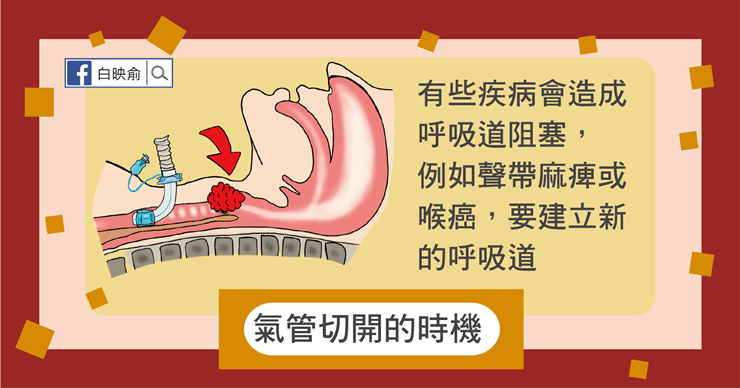 呼吸器