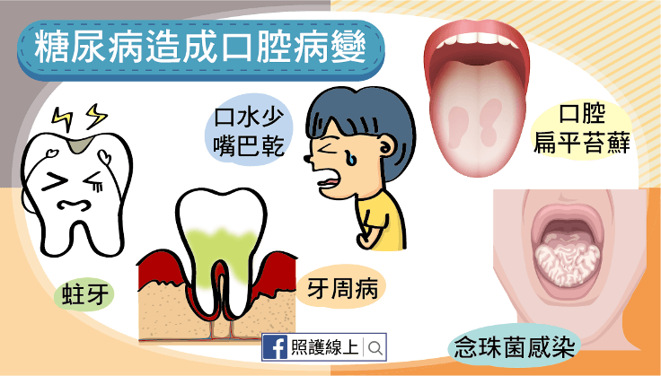 口腔病變