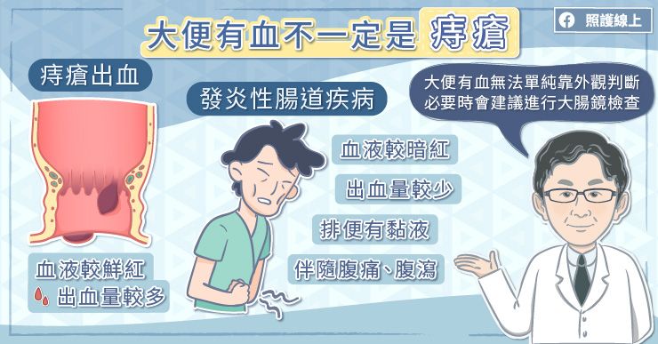 痔瘡