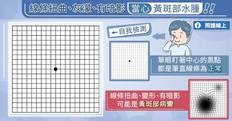 黃斑部