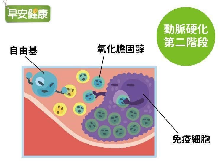 動脈硬化
