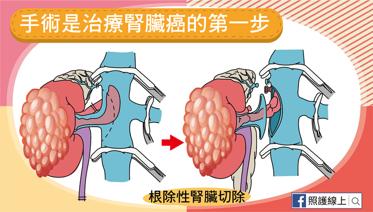 腎臟