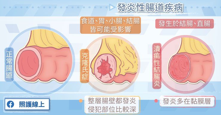 腸道