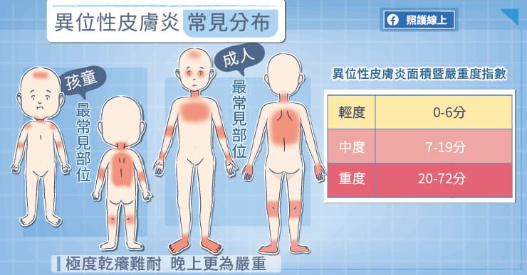 皮膚