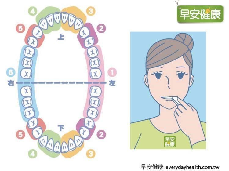 腔問題