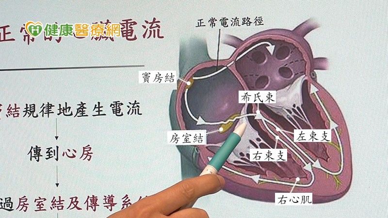 心臟