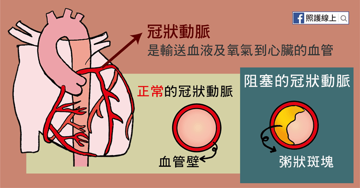 冠狀動脈
