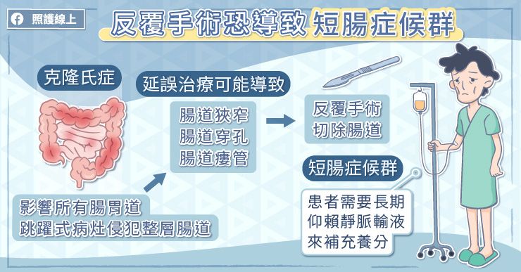 手術