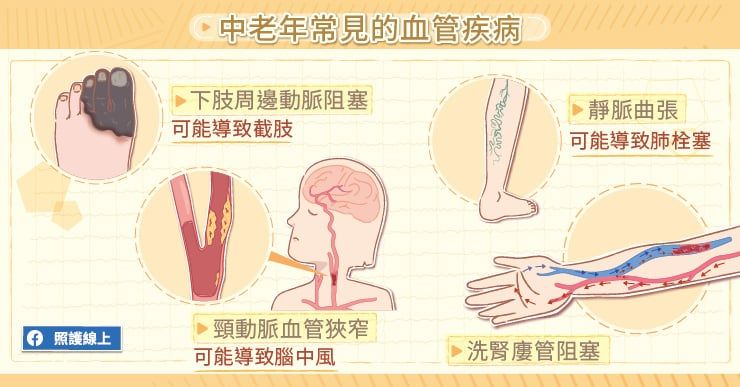 中老年人常見血管問題
