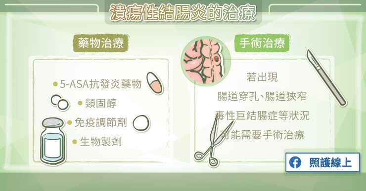 潰瘍性結腸炎有哪些治療方式