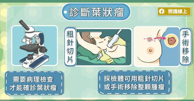 腫瘤