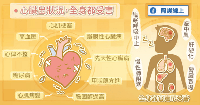 心臟衰竭