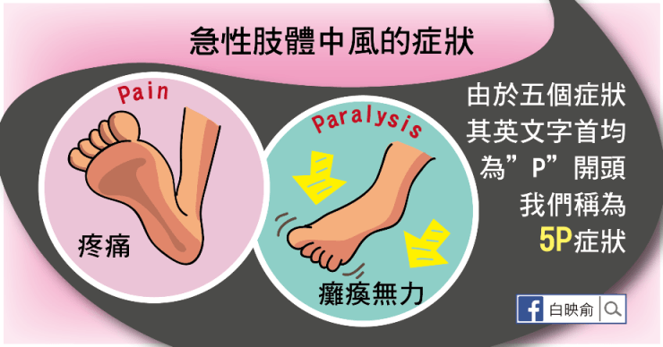 中風