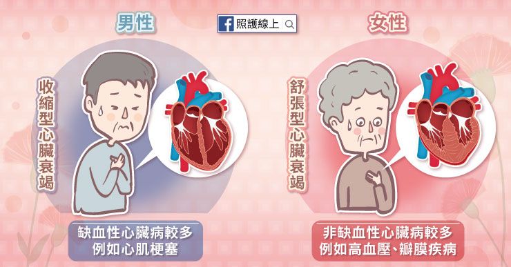 心臟衰竭