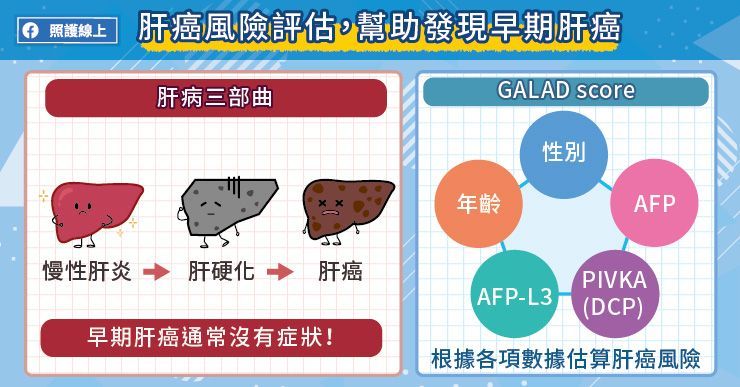GALAD score肝癌風險評估,幫助發現早期肝癌