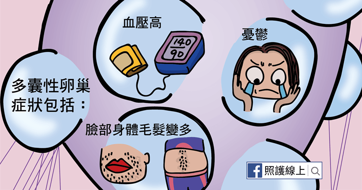 多囊性卵巢