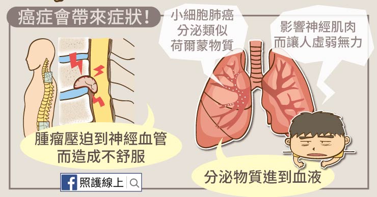 癌症