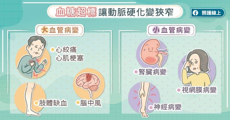血糖超標讓動脈硬化變狹窄