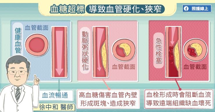 血糖