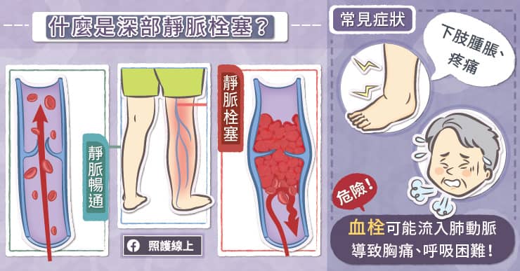 靜脈