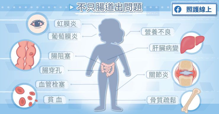 腸道