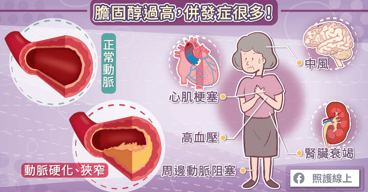 膽固醇