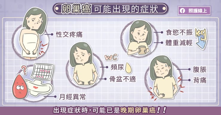 卵巢癌