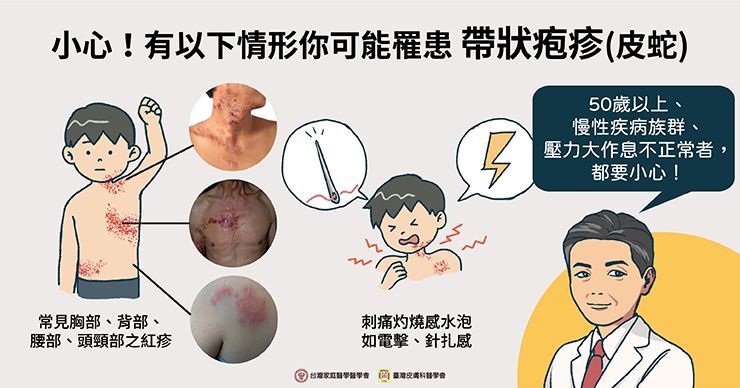 皮蛇