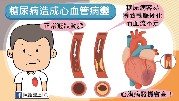 心血管